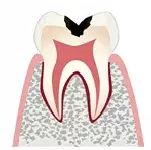 歯科一般画像