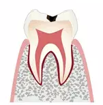歯科一般画像