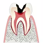 歯科一般